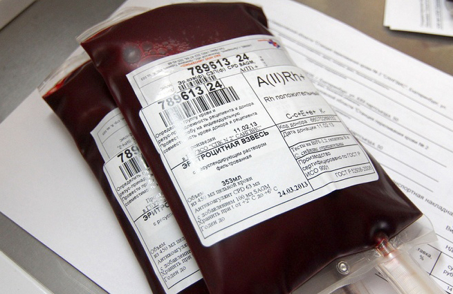 Донор крови екатеринбург. ВИЧ при переливании крови. Стоимость крови для переливания цена. Переливание крови Екатеринбург цена.