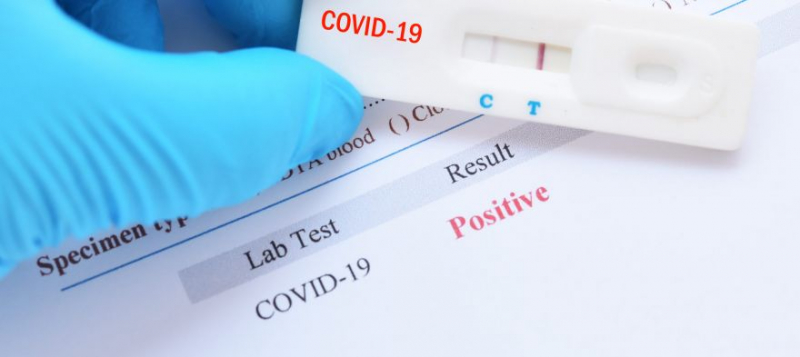 Срок выполнения теста на коронавирус хотят сократить до суток