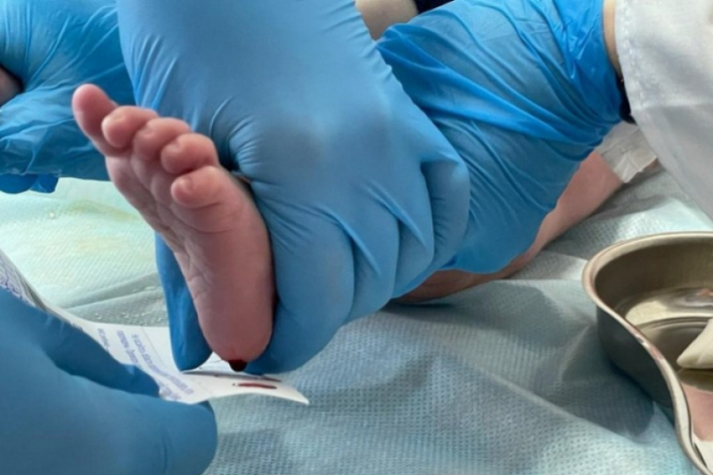 Более тысячи новорожденных прошли неонатальный скрининг с начала года в Севастополе